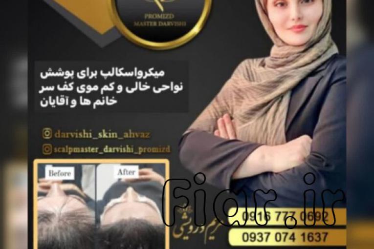 میکرواسکالپ سر